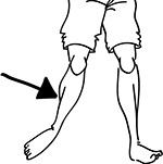 leg